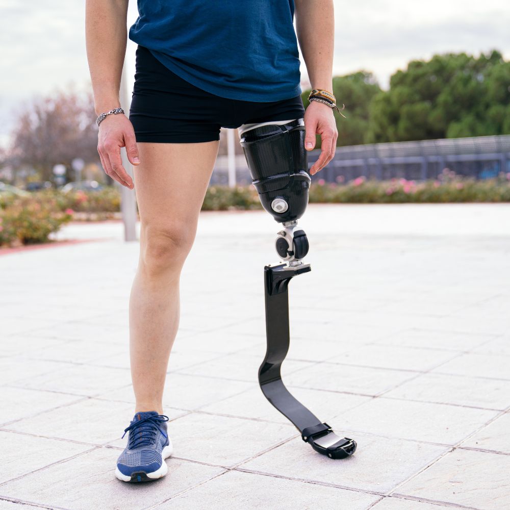 Top 5 prosthetic manufacturers redefining mobility with innovative technology