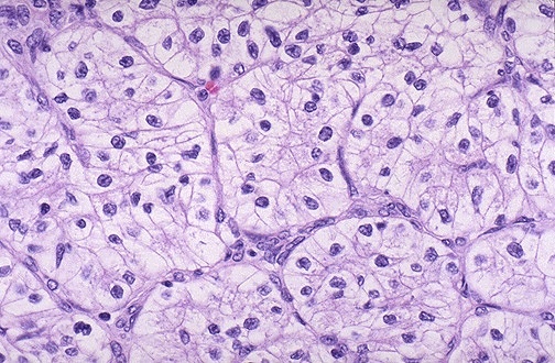 Renal Pathology